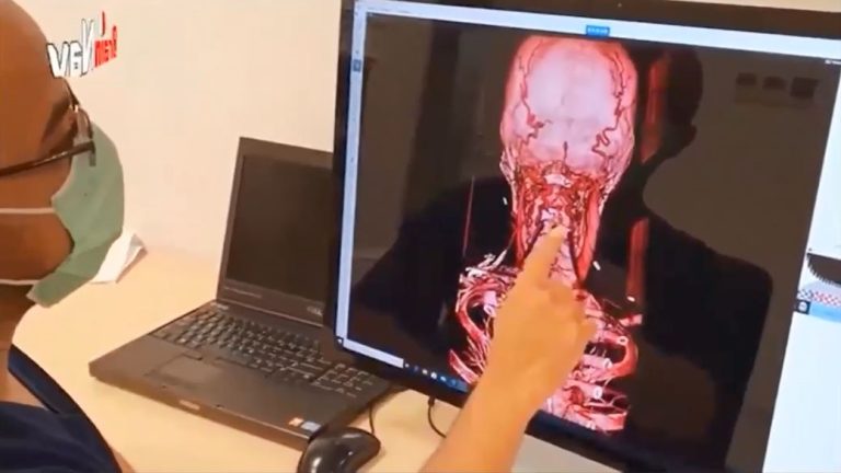 Dukung Bedah Saraf Otak, Profesor ITS Kembangkan Sistem Stereotaktik